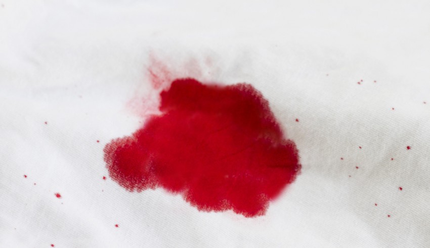 Red Stains On A White Bed Sheet: Virginity Test - pepNewz